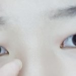 얘들아 나 쌍수 할까말까ㅠ