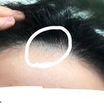 [댓글부탁해] 잔머리를 <b>면도기</b>로 밀었어