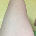 나 허벅지 <b>안쪽</b> 살 씹오짐