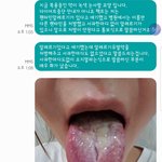 이건 의료사고 아닌가요? 병원측은 사과조차안합니다.(협오사진있습니다...