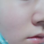 [드루와] 나 피부 개좋당ㅎㅎ