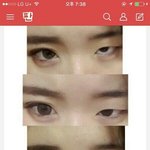 [댓글부탁해] 네이트판 쌍액<b>전후</b> 이 사진 링크 있는사람!!!!