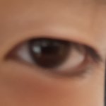 [조언부탁] 쌍수한사람,안한사람 의견좀..ㅠㅠ