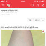 나 <b>허벅</b>지살 씹오진다고 올렸던 앤데