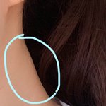 [궁금함] 목에 난 혹 같은거