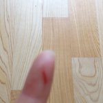 설탕<b>시럽</b>에 손베임ㅠ