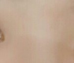 쌍수 할까말까