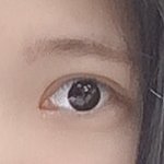 앞트임 할 애들아 절대 많이 째지 마