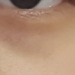 [댓글부탁해] 내 다크<b>써클</b> 붉은기 돌아?