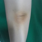 [조언부탁해] 팔꿈치 까만거<b>어뜩</b>해ㅠㅠ?
