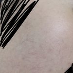 얼굴 <b>핏줄</b> 조카 잘보이는거 개스트레스