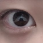 쌍수해야돼ㅠ?