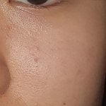 약혐)얘들아 내 <b>모공</b> 많이 넓음 ㅠㅠ?