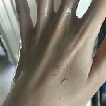 [방탈죄송] 속눈썹 펌 후 속눈썹 뽑힘
