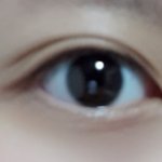 쌍수를 해도 괜찮을 눈이야?