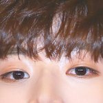 구정모 눈 둘<b>다</b> <b>위</b>에 점 있네