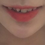 누가 내 <b>치아</b> 교정할 돈 좀 줘라 ~~~~~