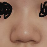 [댓글부탁해] 내 코 뭔코임? <b>복코</b>?