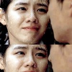 쌍커풀두꺼운거 <b>재수술</b> 할수있나