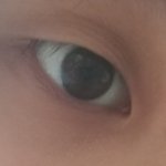 [댓글부탁해] 쌍수 할까말깡?!!!(<b>사진o</b>)
