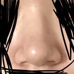 콧볼축소 수술 하면