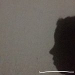 [댓글부탁해] 얘들아̐̈ 나같은 <b>무턱</b>은 어떻게해?ˀ