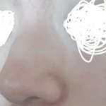 코 때문에 <b>개</b>빡<b>쳐</b>ㅜㅜ(사진있)