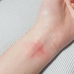 [댓글부탁해] 이거 자해 <b>흉터</b>같애??ㅠ
