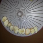 <b>마늘</b>, 이 부분 징그럽지 않나요?