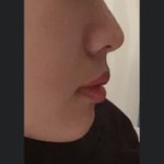 [이것좀봐줘] <b>돌출</b>입 판단