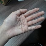 [조언부탁] 나 이거 병인 것 같은데 어떡함