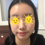 <b>피부</b> 이<b>정도</b>면