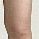 [방탈죄송] 제 <b>종아리알</b> 봐주실분ㅠㅠㅠ