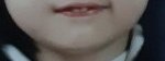 토끼이빨 때문에 10년을 놀림 받았고