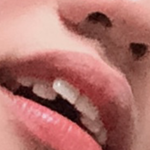 [댓글부탁해] 토끼이빨때매 교정해본 친구드라