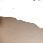 [19] 피부에 이런 거 뭐야?