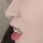 [댓글부탁해] 입 이런거 교정기 떼어<b>내면</b>