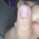 [댓글부탁해] 나 <b>손톱</b> ㅠㅠ