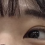 [꼭조언부탁] 나 쌍수 재수술할까