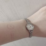 [댓글부탁해] 손목에 자꾸 시계 <b>자국</b> 남는데 정상이냐