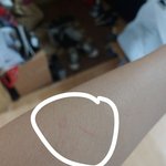 [댓글부탁해] 나 팔에 키스마크 <b>생김</b>