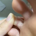 이거 <b>무좀</b>이야? (사진주의)