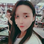 문어이마 탈출, 이마<b>축소</b>+헤어라인