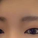 쌍수할말(사진있음)