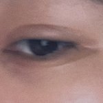 눈 밑에 선 진한 사람 있니????? ㅜㅜ