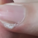 [댓글부탁해] <b>손톱</b>이 이상해 ㅜㅜ