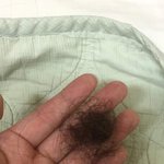 [댓글부탁해] 얘들아 나 <b>탈모</b>냐...