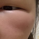 [드루와] +)얘들아 나 얼굴이 심하게 부풀어올랐는데