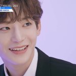 [<b>프듀</b>X] 구정모 얼굴 무슨<b>일</b>?