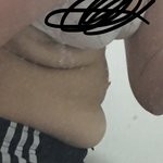 접엇을 <b>때</b> 살 이<b>정도</b>면 심각한거